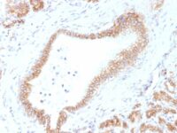 FFPE human pancreas sections stained with 100 ul anti-Beta Catenin (clone CTNNB1/1507) at 1:50. HIER epitope retrieval prior to staining was performed in 10mM Tris 1mM EDTA, pH 9.0.